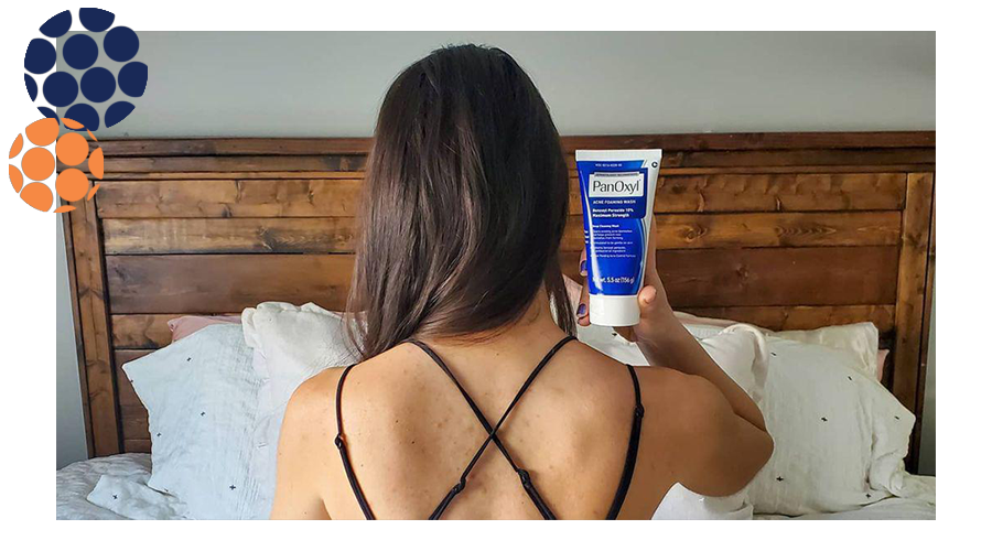 PanOxyl® putojantis prausiklis nuo aknės - benzoilo peroksidas 10 %
